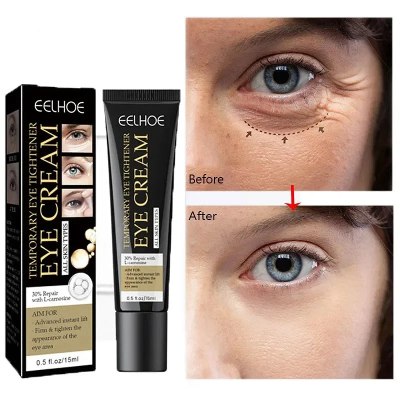 Creme Reparador de Olheiras e Rugas [COMPRE 1 LEVE 2]
